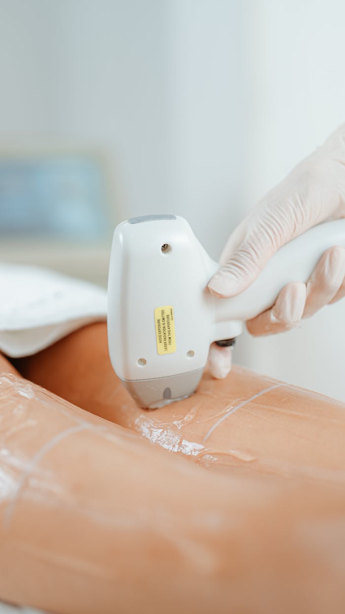 Close-up of laser hair removal procedure in beauty clinic, showcasing diode laser technology on a client's leg.