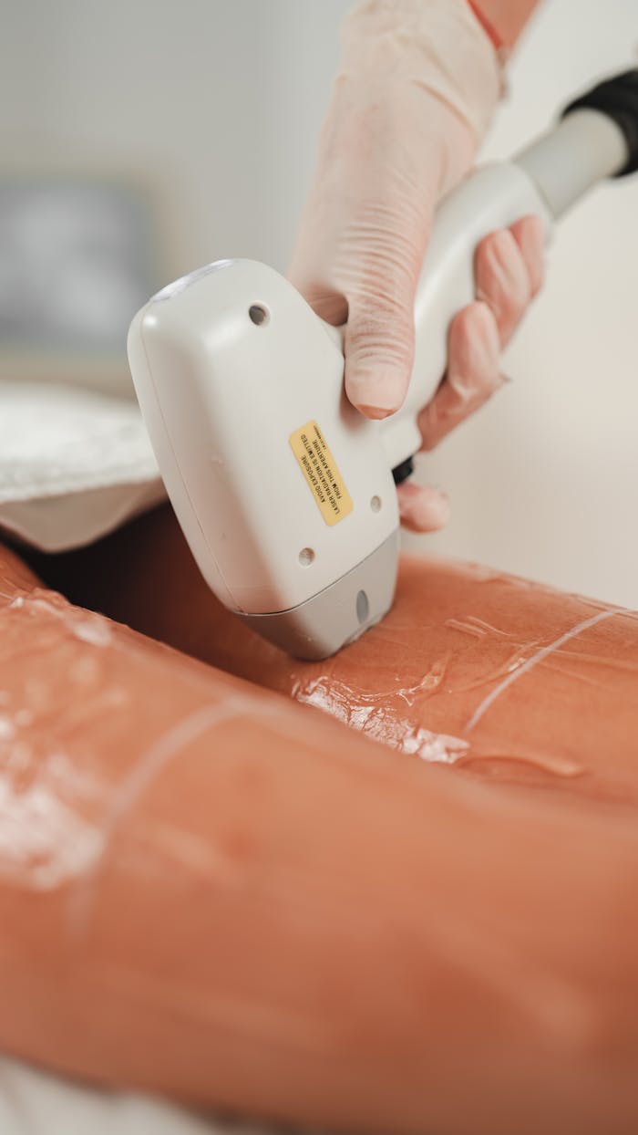 Close-up of laser hair removal process on leg in a beauty clinic, showcasing advanced cosmetic technology.